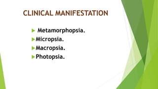 CLINICAL MANIFESTATION
 Metamorphopsia.
Micropsia.
Macropsia.
Photopsia.
 
