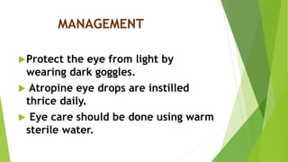 MANAGEMENT
Protect the eye from light by
wearing dark goggles.
 Atropine eye drops are instilled
thrice daily.
 Eye care should be done using warm
sterile water.
 