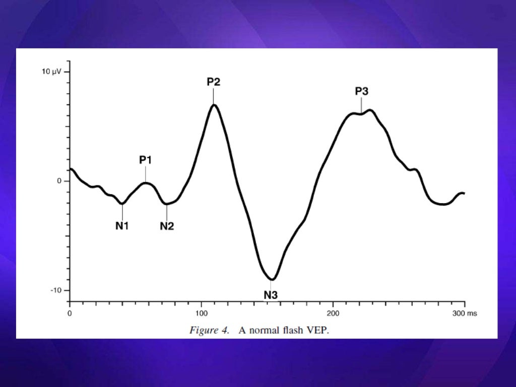 Visual evoked potential