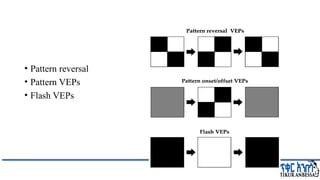 Comprehensive Overview of Visual Evoked Potentials in Neurology | PPTX