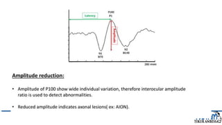 Comprehensive Overview of Visual Evoked Potentials in Neurology | PPTX
