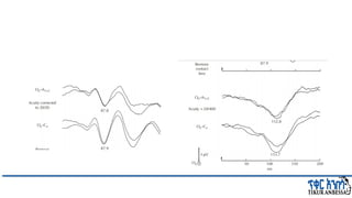 Comprehensive Overview of Visual Evoked Potentials in Neurology | PPTX