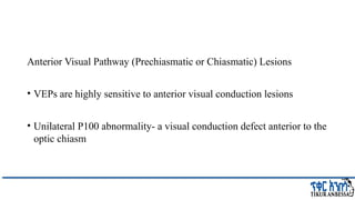 Comprehensive Overview of Visual Evoked Potentials in Neurology | PPTX