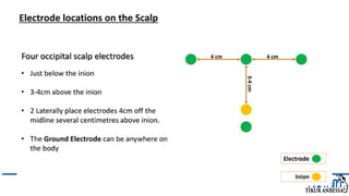 Comprehensive Overview of Visual Evoked Potentials in Neurology | PPTX