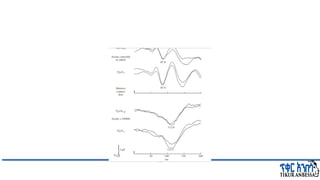 Comprehensive Overview of Visual Evoked Potentials in Neurology | PPTX