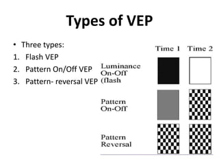 Types of VEP
• Three types:
1. Flash VEP
2. Pattern On/Off VEP
3. Pattern- reversal VEP
 