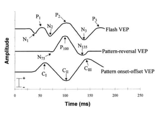 Visual evoked potentials | PPTX