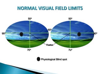 NORMAL VISUAL FIELD LIMITS
60
50 50
90 90
70 7o
Fixation
X X
= Physiological Blind spotX
 