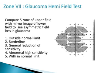 Zone VII : Glaucoma Hemi Field Test
Compare 5 zone of upper field
with mirror image of lower
field to see asymmetric field
loss in glaucoma
1. Outside normal limit
2. Borderline
3. General reduction of
sensitivity
4. Abnormal high sensitivity
5. With in normal limit
 