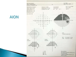 AION
 
