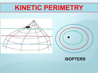 KINETIC PERIMETRY
ISOPTERS
 