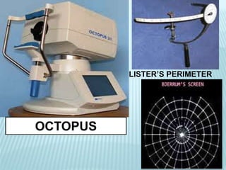 LISTER’S PERIMETER
OCTOPUS
 
