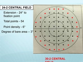 . . . . . . . . .
..
........
. . .
24-2 CENTRAL FIELD
Extension - 24° to
fixation point
Total points - 54
Point density - 6°
Degree of bare area – 3°
30-2 CENTRAL
 