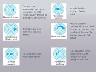 Visual field evaluation | PPTX