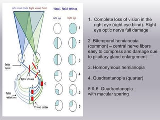 Visual field evaluation | PPTX