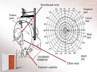 Patient switch
Forehead rest
Chin rest
 