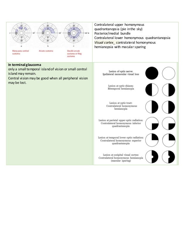  Contralateral upper homonymous
quadrantanopsia (pie in the sky)
 Posterior/medial bundle
 Contralateral lower homonymous quadrantanopsia
 Visual cortex_ contralateral homonymous
hemianopsia with macular sparing

In terminal glaucoma
only a small temporal island of vision or small central
island may remain.
Central vision may be good when all peripheral vision
may be lost.
 