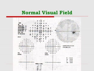 JNTERPRETATION OF SINGLE FIELD PRINTOUT FROM HUMPHREY'S | PPT