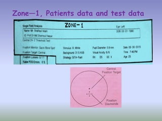 Zone—1, Patients data and test data
 