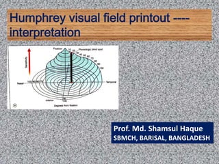 Humphrey visual field printout ----
interpretation
Prof. Md. Shamsul Haque
SBMCH, BARISAL, BANGLADESH
 