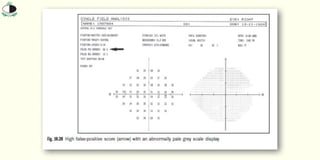 Fc Visual Field Visual_Field_and_Visual_field_Screening-1.pptx