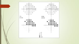 Visual field assessment,optic nerve changes and retinal changes | PPTX