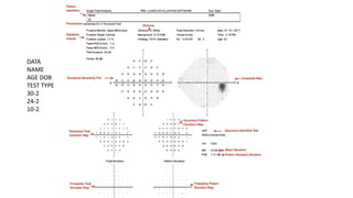DATA
NAME
AGE DOB
TEST TYPE
30-2
24-2
10-2
 