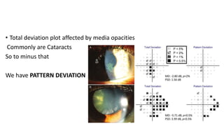 • Total deviation plot affected by media opacities
Commonly are Cataracts
So to minus that
We have PATTERN DEVIATION
 