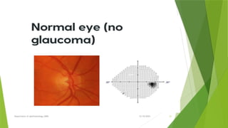 VISUAL FIELD CHANGES IN GLAUCOMA by dr nanish.pptx