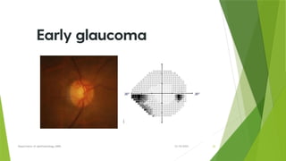 VISUAL FIELD CHANGES IN GLAUCOMA by dr nanish.pptx