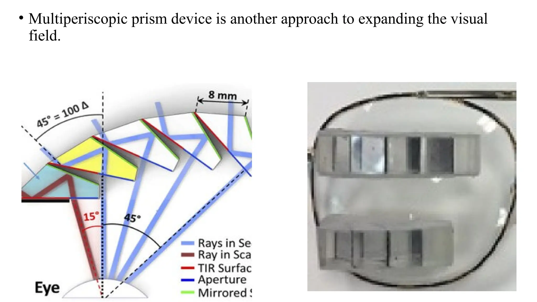 VISUAL FIELD ENHANCING TECHNIQUES FOR PATIENTS WITH HEMIANOPIA FIELD.pptx