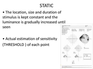 STATIC
• The location, size and duration of
stimulus is kept constant and the
luminance is gradually increased until
seen
• Actual estimation of sensitivity
(THRESHOLD ) of each point
 