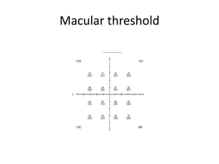 Macular threshold
 