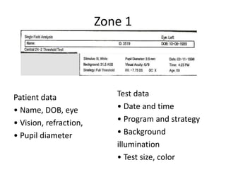 Zone 1
Patient data
• Name, DOB, eye
• Vision, refraction,
• Pupil diameter
Test data
• Date and time
• Program and strategy
• Background
illumination
• Test size, color
 