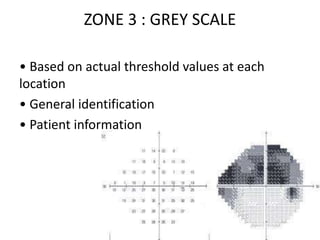 ZONE 3 : GREY SCALE
• Based on actual threshold values at each
location
• General identification
• Patient information
 