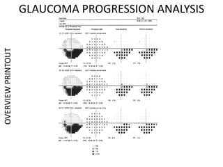 GLAUCOMA PROGRESSION ANALYSISOVERVIEWPRINTOUT
 