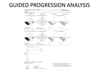 GUIDED PROGRESSION ANALYSIS
 