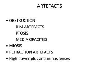 ARTEFACTS
• OBSTRUCTION
RIM ARTEFACTS
PTOSIS
MEDIA OPACITIES
• MIOSIS
• REFRACTION ARTEFACTS
• High power plus and minus lenses
 