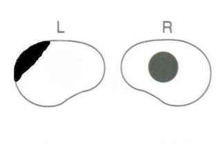 Visual field examination