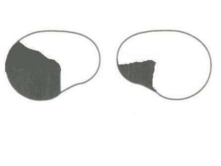 Visual field examination