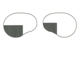 Visual field examination