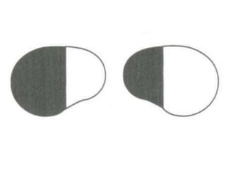 Visual field examination