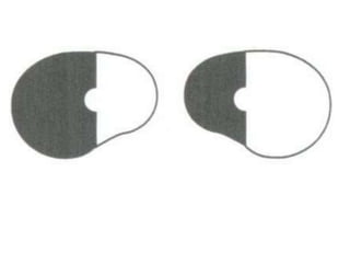 Visual field examination