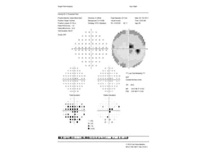 Visual field examination