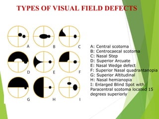 Visual Field Examination suchana ophthalmology.ppt