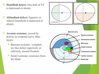 Visual Field Examination suchana ophthalmology.ppt