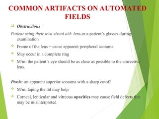 Visual Field Examination suchana ophthalmology.ppt