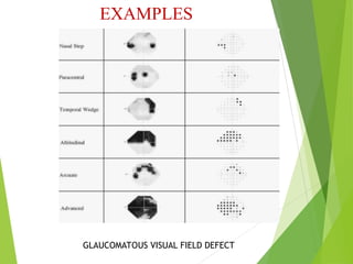 Visual Field Examination suchana ophthalmology.ppt