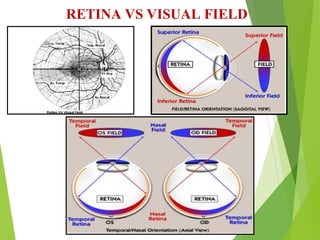 Visual Field Examination suchana ophthalmology.ppt