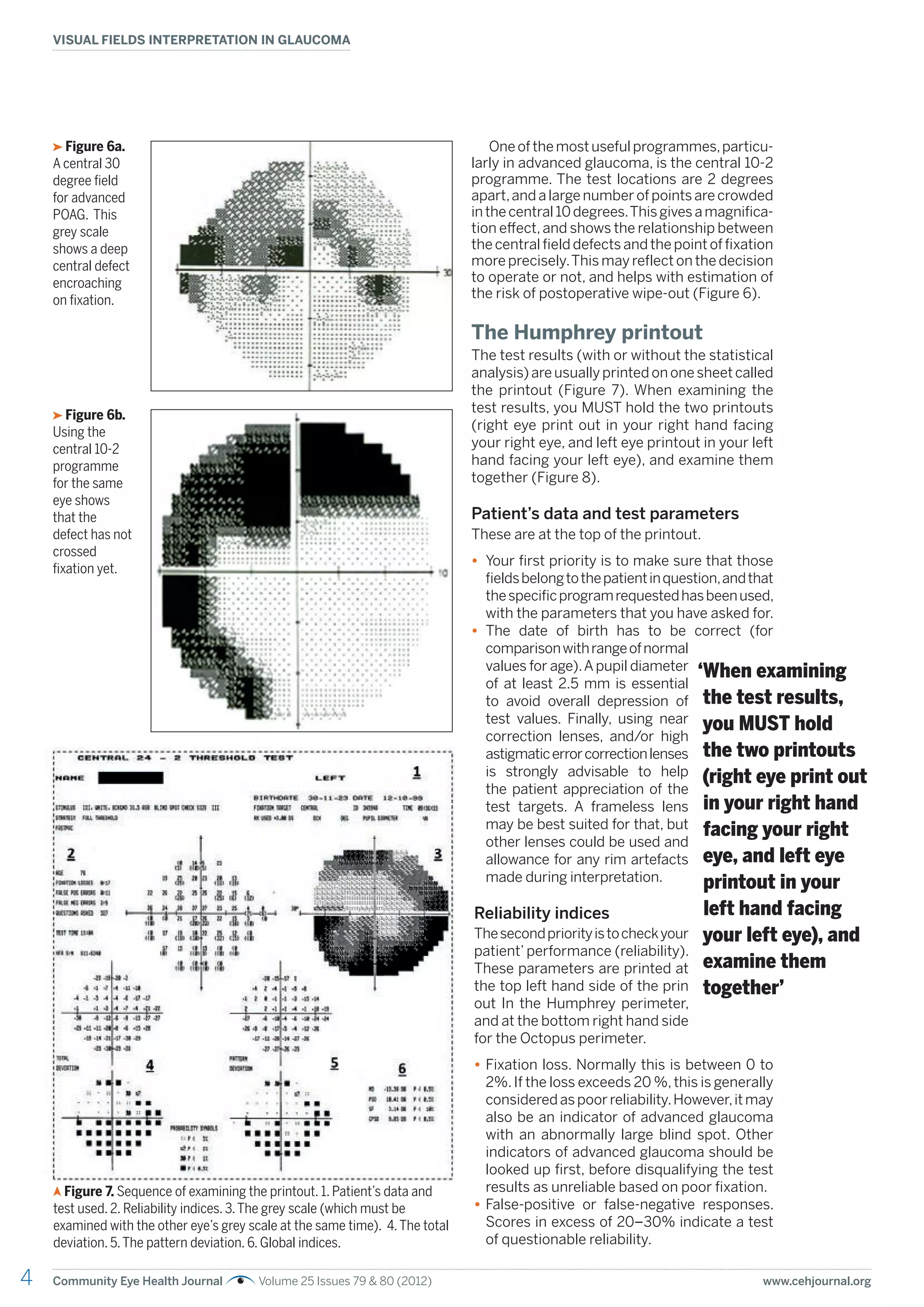 4 Community Eye Health Journal Volume 25 Issues 79 & 80 (2012) www.cehjournal.org
VISUAL FIELDS INTERPRETATION IN GLAUCOMA
Oneofthemostusefulprogrammes,particu-
larly in advanced glaucoma, is the central 10-2
programme. The test locations are 2 degrees
apart,and a large number of points are crowded
inthecentral10degrees.Thisgivesamagnifica-
tion effect,and shows the relationship between
the central field defects and the point of fixation
more precisely.This may reflect on the decision
to operate or not, and helps with estimation of
the risk of postoperative wipe-out (Figure 6).
The Humphrey printout
The test results (with or without the statistical
analysis) are usually printed on one sheet called
the printout (Figure 7). When examining the
test results, you MUST hold the two printouts
(right eye print out in your right hand facing
your right eye, and left eye printout in your left
hand facing your left eye), and examine them
together (Figure 8).
Patient’s data and test parameters
These are at the top of the printout.
• Your first priority is to make sure that those
fieldsbelongtothepatientinquestion,andthat
thespecificprogramrequestedhasbeenused,
with the parameters that you have asked for.
• The date of birth has to be correct (for
comparisonwithrangeofnormal
values for age).Apupil diameter
of at least 2.5 mm is essential
to avoid overall depression of
test values. Finally, using near
correction lenses, and/or high
astigmaticerrorcorrectionlenses
is strongly advisable to help
the patient appreciation of the
test targets. A frameless lens
may be best suited for that, but
other lenses could be used and
allowance for any rim artefacts
made during interpretation.
Reliability indices
Thesecondpriorityistocheckyour
patient’ performance (reliability).
These parameters are printed at
the top left hand side of the prin
out In the Humphrey perimeter,
and at the bottom right hand side
for the Octopus perimeter.
• Fixation loss. Normally this is between 0 to
2%.If the loss exceeds 20 %,this is generally
consideredaspoorreliability.However,itmay
also be an indicator of advanced glaucoma
with an abnormally large blind spot. Other
indicators of advanced glaucoma should be
looked up first, before disqualifying the test
results as unreliable based on poor fixation.
• False-positive or false-negative responses.
Scores in excess of 20–30% indicate a test
of questionable reliability.
Figure 6a.
A central 30
degree field
for advanced
POAG. This
grey scale
shows a deep
central defect
encroaching
on fixation.
Figure 6b.
Using the
central 10-2
programme
for the same
eye shows
that the
defect has not
crossed
fixation yet.
Figure 7. Sequence of examining the printout. 1. Patient’s data and
test used. 2. Reliability indices. 3.The grey scale (which must be
examined with the other eye’s grey scale at the same time). 4.The total
deviation. 5.The pattern deviation. 6. Global indices.
‘When examining
the test results,
you MUST hold
the two printouts
(right eye print out
in your right hand
facing your right
eye, and left eye
printout in your
left hand facing
your left eye), and
examine them
together’
 